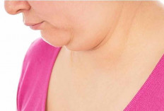 Tips Aman Hilangkan Lipatan Lemak di Leher 