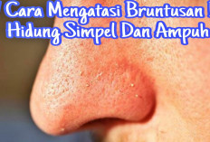 7 Cara Mengatasi Bruntusan Di Hidung Yang Efektif, Yuk Simak Disini