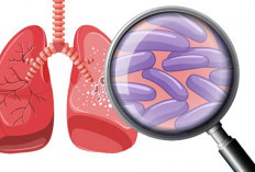 Sepanjang 2025, Ada 2.711 Warga Muratara Terinfeksi TBC