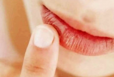 Cara Mudah Hilangkan Bibir Kering dan Pecah-pecah Hingga Kembali Cerah 