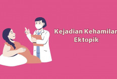 Smart Fertility Clinic AR Bunda Bagikan Faktor yang Mempengaruhi Kesuburan Pria dan Wanita  