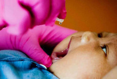 KLB Polio Resmi Berakhir Namun Resiko Polio Masih Ada di Indonesia