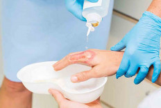 Pentingnya Perawatan Diri yang Tepat untuk Luka Bakar Ringan di Rumah