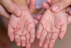 Data Dinkes Lubuk Linggau Minggu Kedua Juli 54 Orang Suspect Flu Singapura