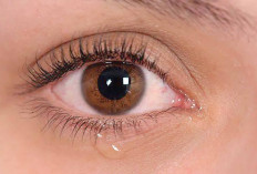 Mata Perih dan Berair, Ini Penyebab dan Cara Mengatasinya dengan Tepat