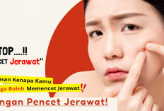 Mencet Jerawat Bukan Solusi, Begini Perawatan Mudah Jauh dari Wajah Berjerawat