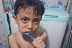 57 Persen Masyarakat Alami Masalah Kesehatan Gigi dan Mulut, Ini Penyebabnya 