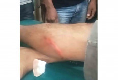 Hendak Belanja di Warung Petani di Muratara Dibacok Pelaku Sebanyak 4 Kali 