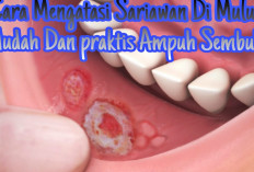 7 Cara Mengatasi Sariawan Di Mulut Dengan Mudah Dan Praktis, Yuk Simak Disini