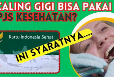 Begini Cara Scaling Gigi Gratis Pakai BPJS Kesehatan, Buruan Cek 3 Syaratnya!