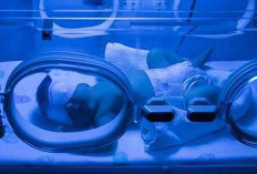 Ini Penyebab dan Gejala Bayi Kuning 