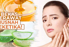 Usai Enyahkan Jerawat di Wajah, Hilangkan juga Noda Bekas Jerawat dengan 6 Bahan Alami Ini 