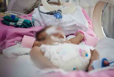 Hati-hati, Gaya Hidup Bumil Tak sehat Bisa Sebabkan PJB 