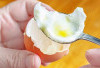 Jangan Sering Makan Telur, Kadar Kolesterol Bisa Tinggi