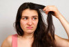 Bikin Enggak PeDe, Ternyata Ini 5 Penyebab Rambut Lepek yang Harus Segara Diatasi
